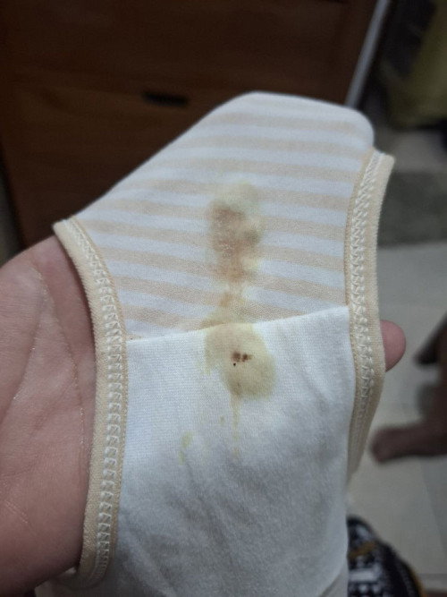 Keputihan campur darah/ atau air ketuban ya?