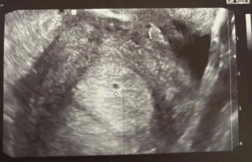 5weeks and 3days