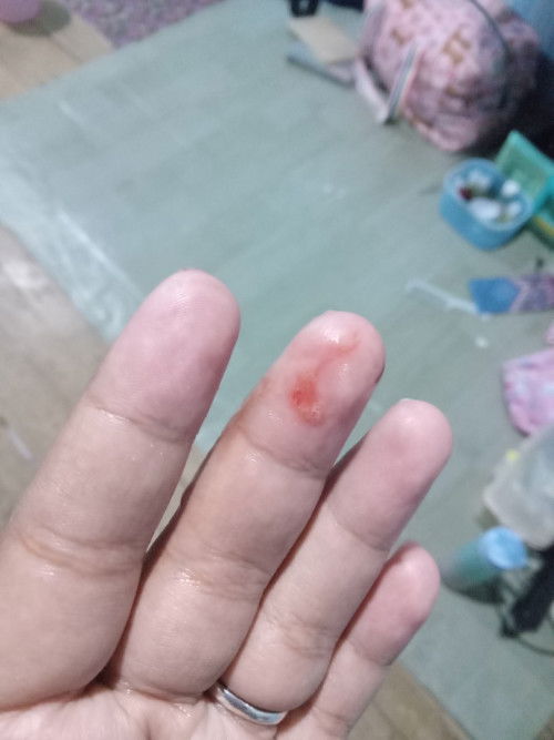 Ada yang sama gk mom