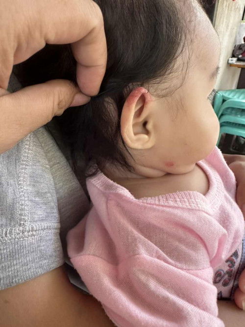 Hello po bka alam nyo po ano gamot dto meron kc ang baby ko