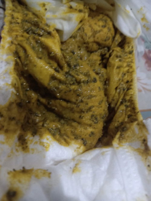 Baby Stool after eating banana