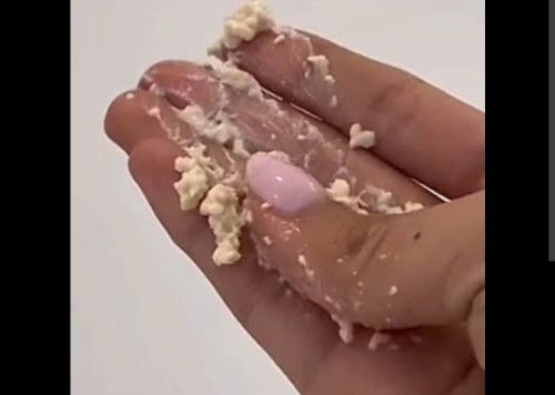Sharing bun.Keputihan seperti ampas tahu, atau parutan keju. Adakah yg sama Bun. Hamil 37 Minggu.