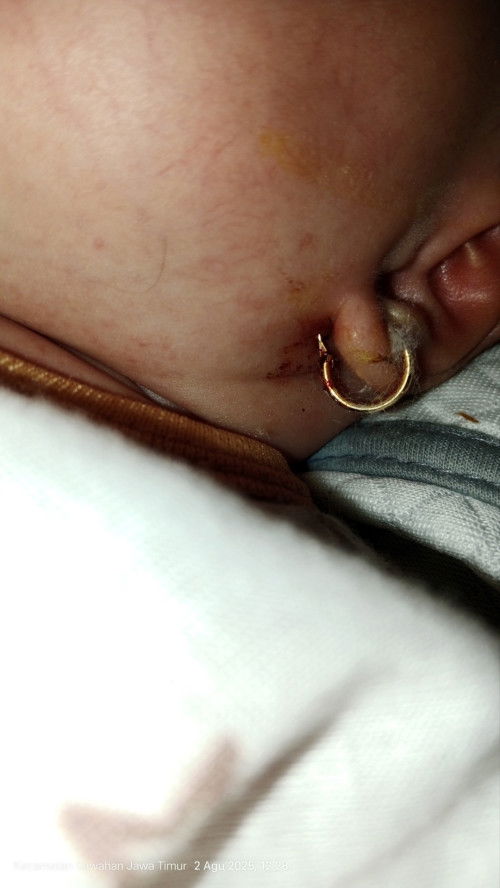 Tindik telinga bayi 15 hari