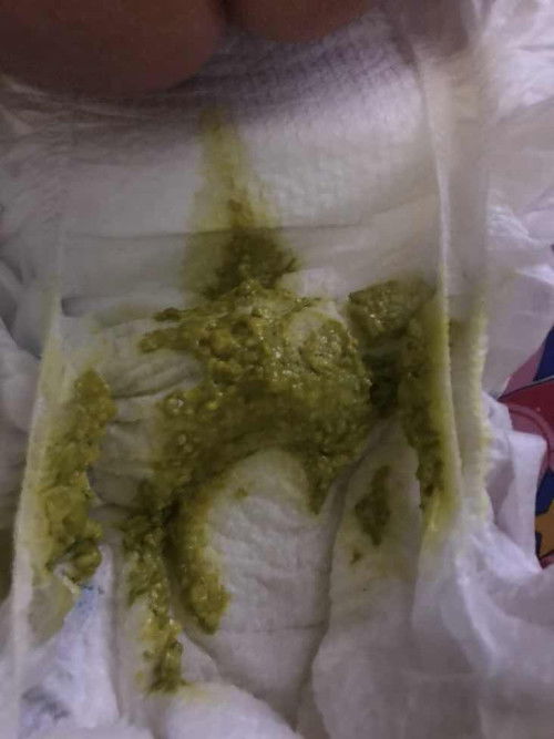 Poop for 2 Months Okd