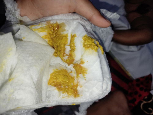 PUP bayi 2,5 bulan