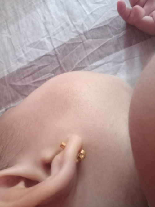 Mga maliliit na butlig sa balat Ng toddler.
