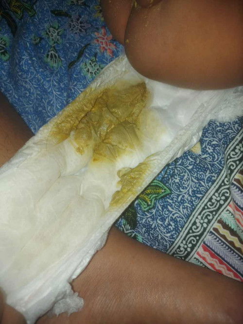 pup bayi normal apa tidak?