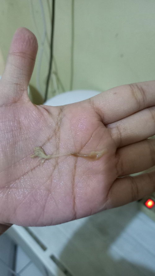 Tiba tiba keluar lendir seperti di foto