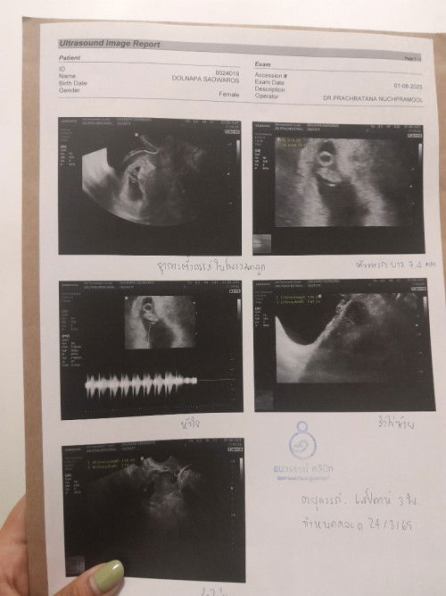6วีค 4วัน👶