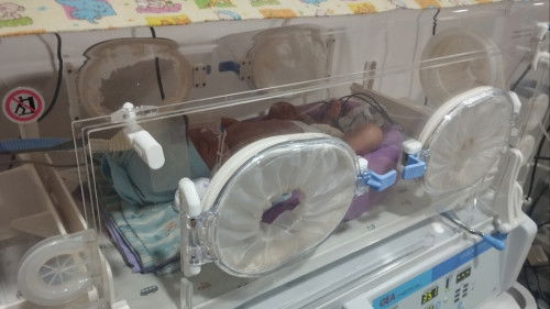 Bayi 22 hari masuk nicu karena batuk