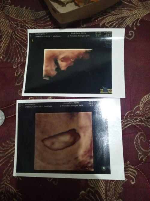 Down banget sama omongan dokternya