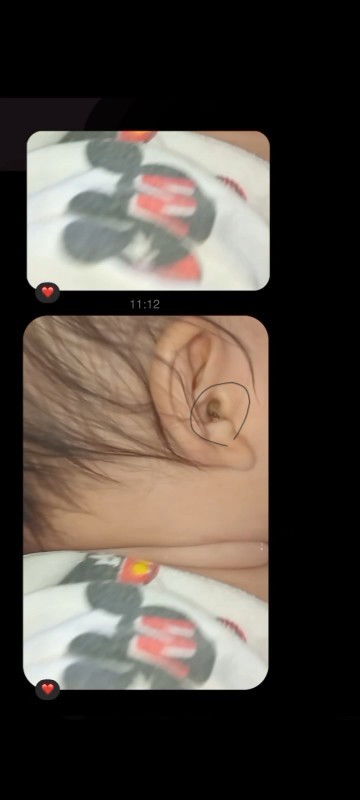 สอบถามแม่ๆหน่อยค่ะ
