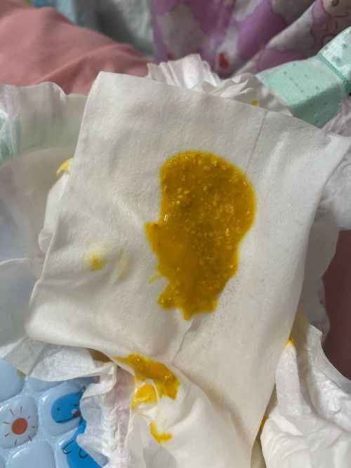 ลูก13วันอึเเบบนี้ปกติมั้ยคะ