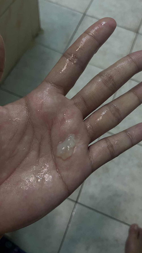 อันนี้คือมูกรึว่าตกขาวคะ