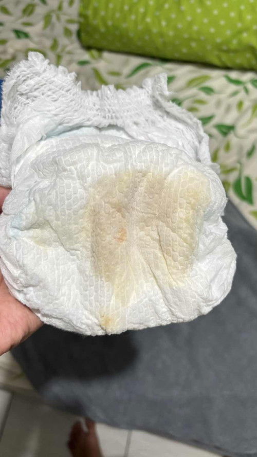 Pipis normal anak 4 bulan