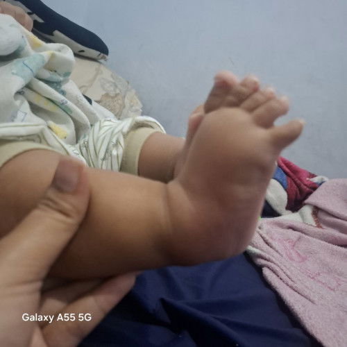 Kaki bayi 4,5 bln terkilir bengkak dikasih apa ya bund. Rencana  mau ke bidan langsung ini..