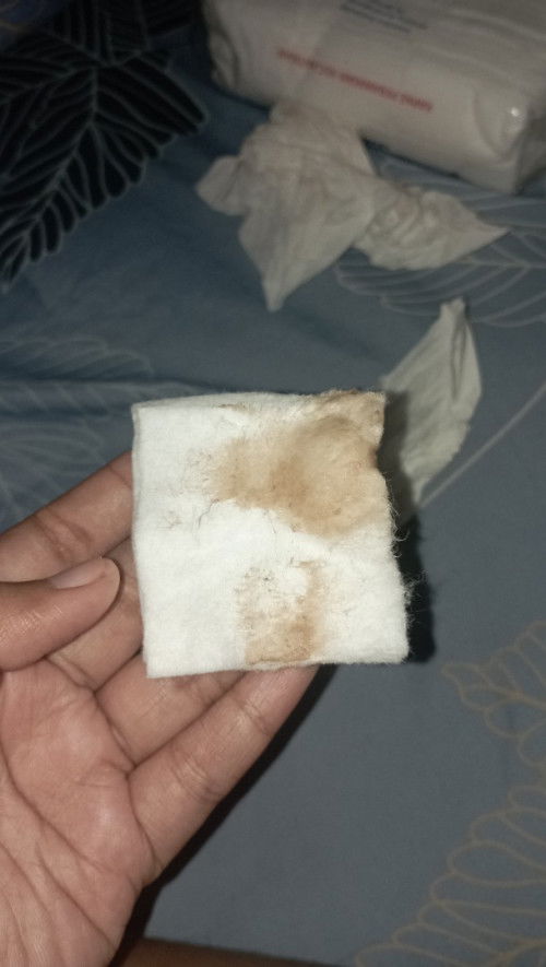 Flek 6 week berwarna coklat, 3 hari berturut turut. Hanya keluar sekali sehari.