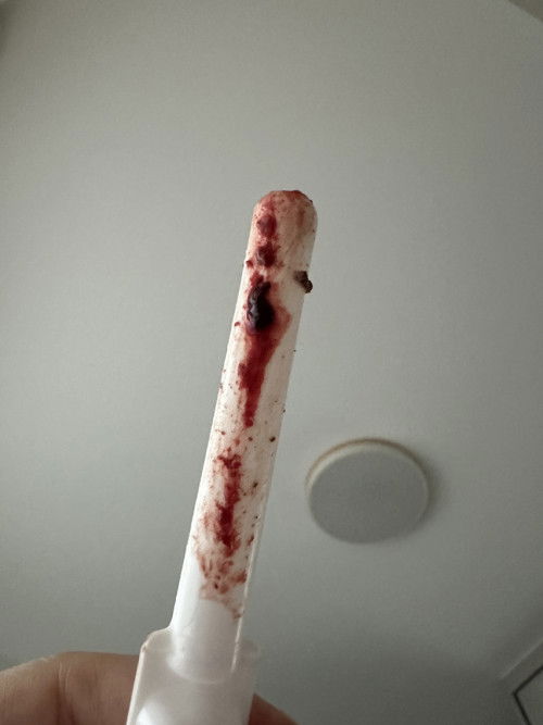 week 5 bleeding