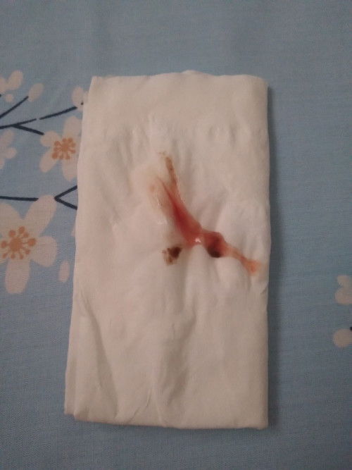 Lendir campur darah sedikit
