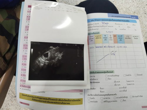อยากได้ลูก