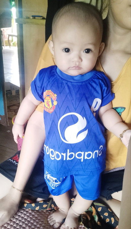Mau nanya bund,awal lahiran kepala bayiku bulat sempurna TPI seiring waktu di usia 4/5 bulan tiba²