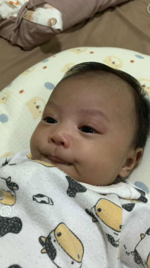 น้องอายุ1เดือน19วัน เปลือกตาน้องแดงแบบนี้คือเป็นอะไรมั้ยคะ กินนมปกติไม่มีไข้แต่ดูซึมนิดหน่อยอยากหลับตา เป็นวันนี้วันที่2ค่ะ สงสารลูก