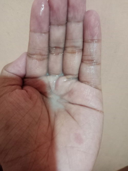 Ano po kaya ito lumabas sa akin discharge