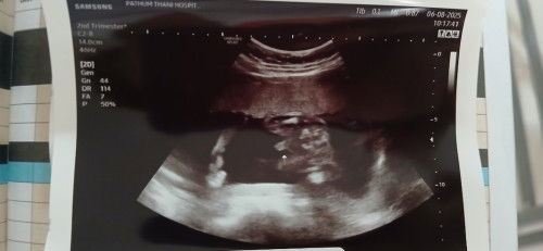 #ทีมธันวาคม.แม่อยากได้ลูกสาว พ่ออยากได้ลูกชาย..👶สมใจพ่อเค้า..#แม่ทีมธันวาคม..ได้ชายหรือหญิงค่ะ