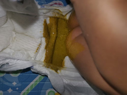 Pup bayi 1,5 bulan