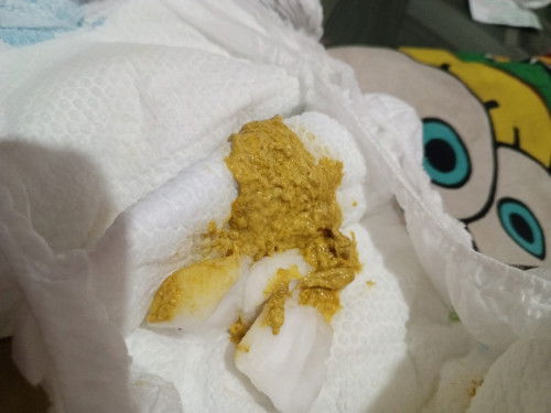Normal ba poops nya?