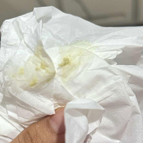 Keputihan mohon dijawab bund