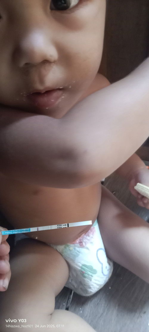 Bulan 5 Tgl 20 HPHT Dan Di Tes Tgl 24 Bulan 6 Garis 2 Agak Samar Dan Q Tes Lgi Baru Jelas itu berapa