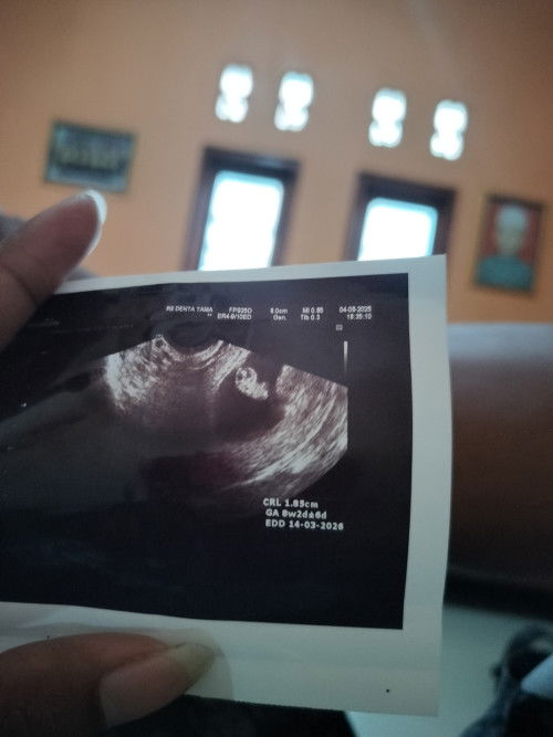dok mau tanya gambar usg ini bertanda sudah ada janin apa belum dok..trmksih