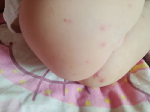 ลูกน้อยวัย10เดือน