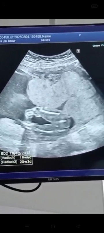 Gender baby