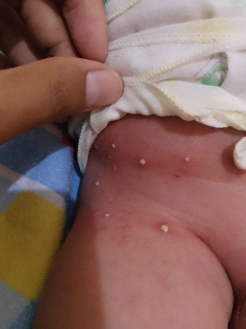 Bayi usia 17 hari