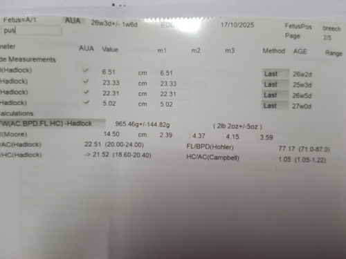 Berat baby scan dari Kk