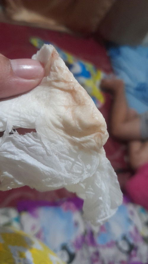 Keputihan coklat