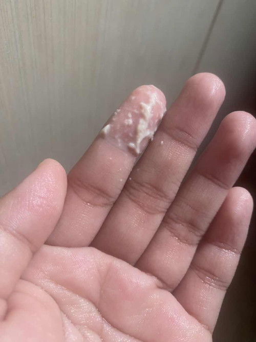 Hamil 37 minggu keputihan begini normal ga ya bun ?