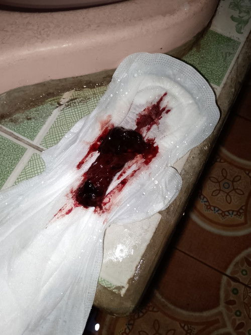 Ada yang tau ga bun ini kenapa?