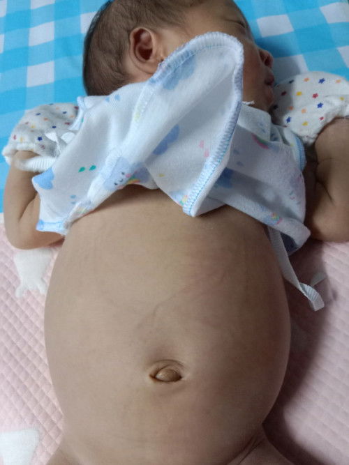 แบบนี้น้องท้องอืดไหมคะ