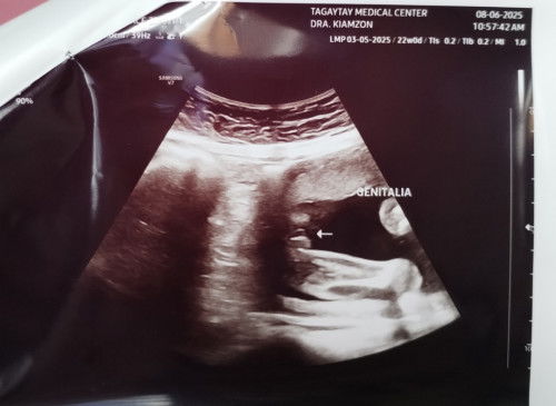 Is this a boy or girl?