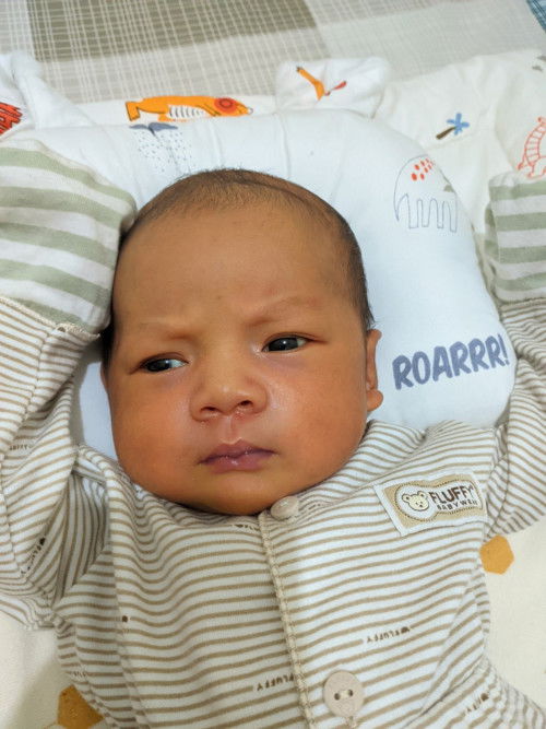 Bayi umur 10 hari keliatan kuning