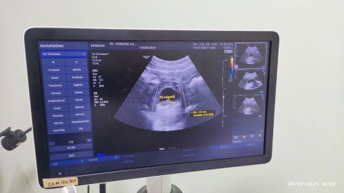 Selamat jalan anak pertama ku baby "Muhammad Antonella"
Mama & Papa sayang banget sama kamu.