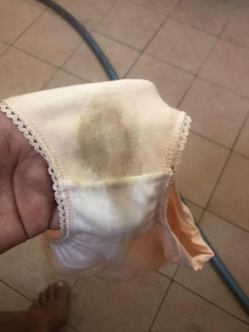 Apakah ini flek coklat?