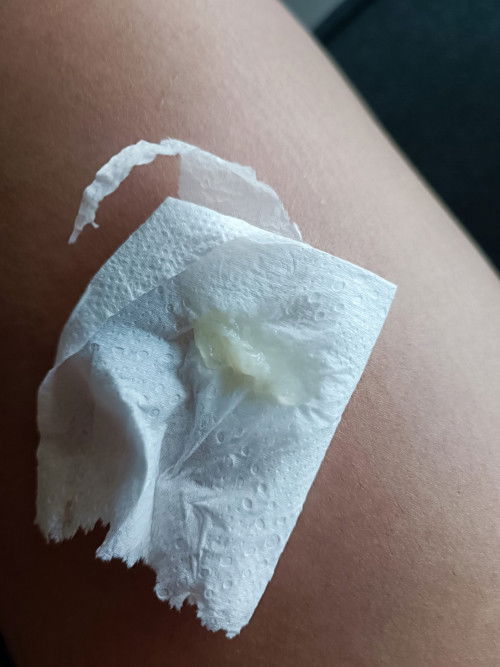 37วีค มีอาการแบบนี้ควรไปโรงบาลไหมคะ รบกวนขอคำแนะนำค่ะ