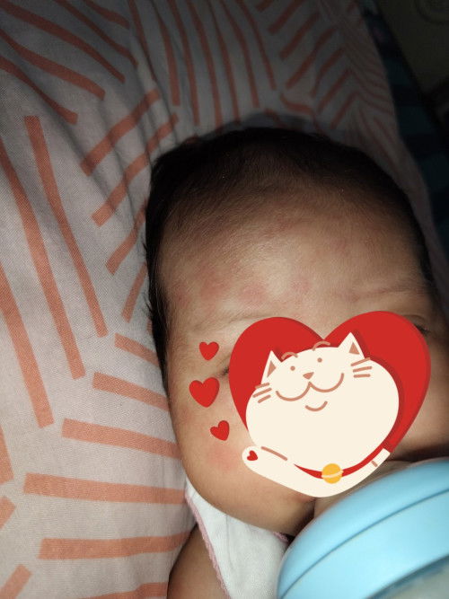 Muka anak merah-merah