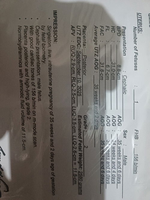 35weeks first time mom