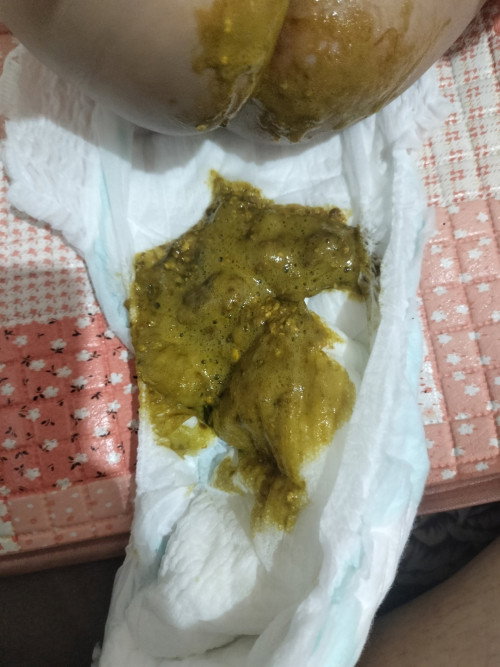 Bun sharing dong, kalau pupnya kekgni normal ga ya