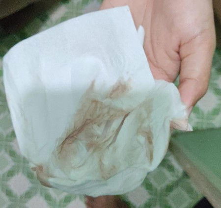 Flek coklat tanpa lendir pertanda apa?